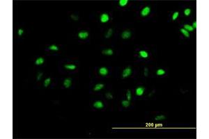 Immunofluorescence (IF) image for anti-Centromere Protein H (CENPH) (AA 1-247) antibody (ABIN528745)