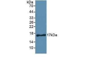 Detection of Recombinant CD40L, Human using Monoclonal Antibody to Cluster Of Differentiation 40 Ligand (CD40L) (CD40 Ligand 抗体  (AA 180-261))
