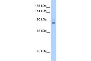 TPX2 antibody used at 0. (TPX2 抗体)