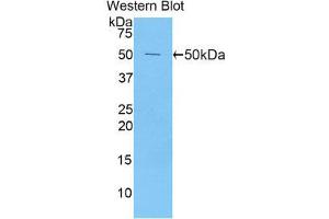 Western Blotting (WB) image for anti-Peroxiredoxin 1 (PRDX1) (AA 1-199) antibody (ABIN3204954) (Peroxiredoxin 1 抗体  (AA 1-199))