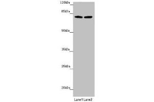 Western blot All lanes: FBXL5 antibody at 1. (FBXL5 抗体  (AA 1-310))