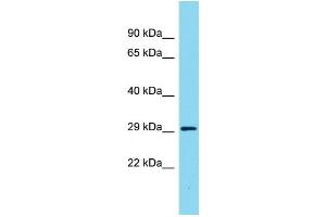 Host: Rabbit Target Name: ARHGAP11B Sample Type: Fetal Heart lysates Antibody Dilution: 1. (ARHGAP11B 抗体  (C-Term))