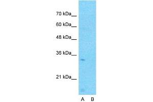 Host:  Rabbit  Target Name:  CCDC90A  Sample Type:  Human Fetal Lung  Lane A:  Primary Antibody  Lane B:  Primary Antibody + Blocking Peptide  Primary Antibody Concentration:  1ug/ml  Peptide Concentration:  5ug/ml  Lysate Quantity:  25ug/lane/lane  Gel Concentration:  0. (CCDC90A 抗体  (Middle Region))