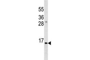 Anti-Insulin antibody western blot analysis in ZR-75-1 lysate. (Insulin 抗体  (AA 35-64))