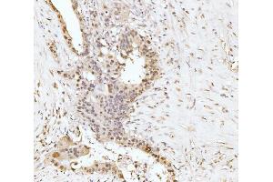 IHC analysis of RRP4/EXOSC2 using anti-RRP4/EXOSC2 antibody (ABIN7602188). (EXOSC2 抗体  (AA 62-293))
