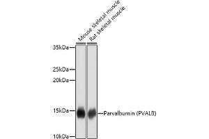 Western blot analysis of extracts of various cell lines, using Parvalbumin (PVALB) antibody (ABIN3016700, ABIN3016701, ABIN3016702 and ABIN6219820) at 1:1000 dilution. (PVALB 抗体)