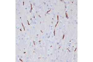 Immunohistochemistry of paraffin-embedded mouse brain using  antibody (ABIN6129926, ABIN6136997, ABIN6136998 and ABIN6218500) at dilution of 1:100 (40x lens). (APOA1 抗体  (AA 25-267))