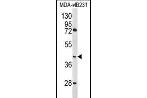 Western blot analysis of HOMER3 Antibody (Center) (ABIN652274 and ABIN2841157) in MDA-M cell line lysates (35 μg/lane). (HOMER3 抗体  (AA 281-308))