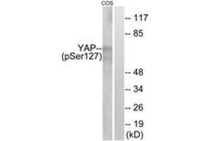 Western blot analysis of extracts from COS7 cells treated with HU 2nM 24h, using YAP (Phospho-Ser127) Antibody. (YAP1 抗体  (pSer127))