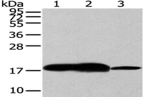 Gel: 12 % SDS-PAGE,Lysate: 40 μg,Lane 1-3: Human fetal brain tissue, Mouse brain tissue, Hela cells,Primary antibody: ABIN7193008(VAMP2 Antibody) at dilution 1/200 dilution,Secondary antibody: Goat anti rabbit IgG at 1/8000 dilution,Exposure time: 30 seconds (VAMP2 抗体)