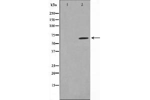 Western blot analysis on MDA-MB-435 cell lysate using PIAS1 Antibody,The lane on the left is treated with the antigen-specific peptide. (PIAS1 抗体  (N-Term))