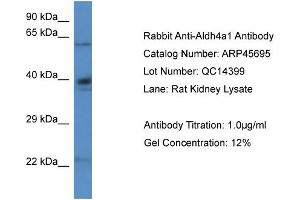 Western Blotting (WB) image for anti-Aldehyde Dehydrogenase 4 Family, Member A1 (ALDH4A1) (N-Term) antibody (ABIN2782322) (ALDH4A1 抗体  (N-Term))
