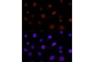 Immunofluorescence analysis of L-929 cells using GLI2 antibody (ABIN7267384) at dilution of 1:100. (GLI2 抗体)