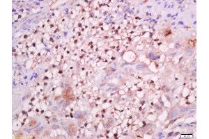 Formalin-fixed and paraffin embedded mouse placenta labeled with Anti-GCMA Polyclonal Antibody, Unconjugated  at 1:200 followed by conjugation to the secondary antibody and DAB staining. (GCM1 抗体  (AA 121-220))