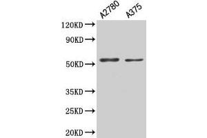 Western Blot Positive WB detected in: A2780 whole cell lysate, A375 whole cell lysate All lanes: PAX3 antibody at 5.