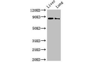 Western Blot Positive WB detected in: Rat liver tissue, Rat lung tissue All lanes: DENND1C antibody at 3 μg/mL Secondary Goat polyclonal to rabbit IgG at 1/50000 dilution Predicted band size: 88, 83 kDa Observed band size: 88 kDa (DENND1C 抗体  (AA 601-801))