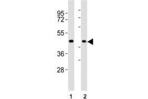 Western blot testing of CCR1 antibody at 1:2000 dilution. (CCR1 抗体  (AA 13-44))