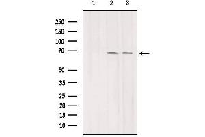 Western blot analysis of extracts from various samples, using SLC7A3 Antibody. (SLC7A3 抗体  (Internal Region))