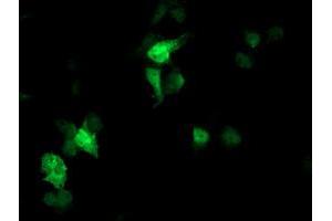 Anti-FBXO21 mouse monoclonal antibody (ABIN2455370) immunofluorescent staining of COS7 cells transiently transfected by pCMV6-ENTRY FBXO21 (RC223095). (FBXO21 抗体)