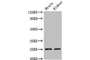 Western Blot Positive WB detected in: Mouse brain tissue, Mouse kidney tissue All lanes: CLDN10 antibody at 2.