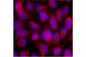 Image no. 3 for anti-Mitogen-Activated Protein Kinase Kinase Kinase 5 (MAP3K5) (Ser83) antibody (ABIN197310) (ASK1 抗体  (Ser83))
