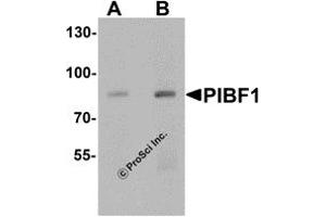 Western Blotting (WB) image for anti-Progesterone Immunomodulatory Binding Factor 1 (PIBF1) (C-Term) antibody (ABIN1077444) (PIBF1 抗体  (C-Term))