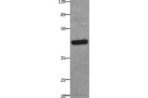 Western blot analysis of A549 cell, using PTGER2 Polyclonal Antibody at dilution of 1:100 (PTGER2 抗体)