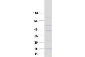 Western Blotting (WB) image for Ring-Box 1, E3 Ubiquitin Protein Ligase (RBX1) protein (Myc-DYKDDDDK Tag) (ABIN2730648)