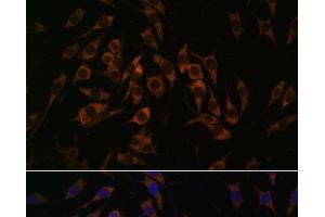 Immunofluorescence analysis of L929 cells using RPS13 Polyclonal Antibody at dilution of 1:100. (RPS13 抗体)
