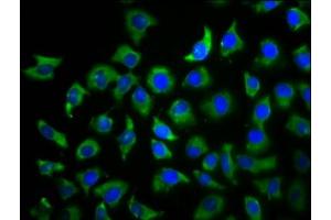 Immunofluorescence staining of A549 cells with ABIN7173750 at 1:100, counter-stained with DAPI. (TBCD 抗体  (AA 2-96))