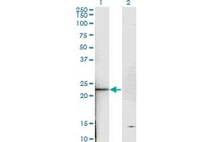 Western Blot analysis of TNNI2 expression in transfected 293T cell line by TNNI2 monoclonal antibody (M05), clone 2D5. (TNNI2 抗体  (AA 2-100))