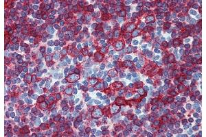 Immunohistochemistry staining of human small intestine (paraffin-embedded sections) with anti-HLA-DR+DP (HL-38). (HLA-DP/DR 抗体)