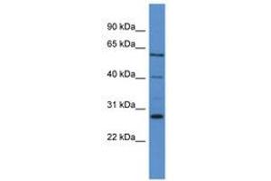 Image no. 1 for anti-Cytochrome P450, Family 24, Subfamily A, Polypeptide 1 (CYP24A1) (AA 263-312) antibody (ABIN6746768) (CYP24A1 抗体  (AA 263-312))