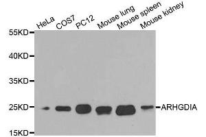 Western Blotting (WB) image for anti-rho GDP Dissociation Inhibitor (GDI) alpha (ARHGDIA) (AA 1-204) antibody (ABIN3021744)