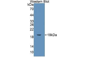 FKBP2 anticorps  (AA 1-142)