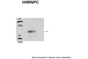 Sample type: human aveolar basal endothelial cells (25ug)Primary Dilution: 1:1000Secondary Antibody: Goat anti-Rabbit-HRPSecondary Dilution: 1:5000Image Submitted by: Andreas Eisenreich Charite Universitatsmedizin Berlin
