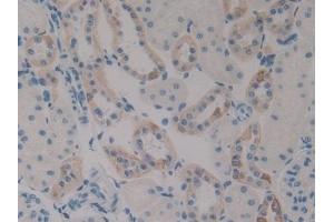 #VALUE! (PLAU 抗体  (AA 17-432))