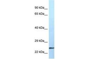 Image no. 1 for anti-Ephrin A2 (EFNA2) (AA 76-125) antibody (ABIN6747487)