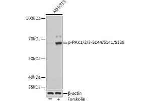 Western blot analysis of extracts of various cell lines, using Phospho-P/2/3-S144/S141/S139 Rabbit mAb (ABIN7269150) at 1:1000 dilution. (PAK1/2/3 抗体  (pSer139, pSer141, pSer144))