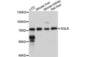 Western blot analysis of extracts of various cells, using SQLE antibody. (SQLE 抗体)