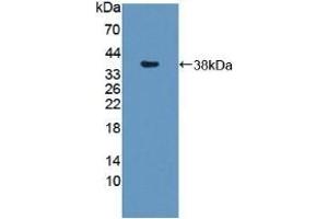 Detection of Recombinant SNTb1, Mouse using Polyclonal Antibody to Syntrophin Beta 1 (SNTb1)