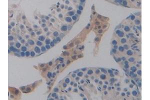 Immunohistochemistry (IHC) image for anti-CD274 (PD-L1) (AA 48-290) antibody (ABIN7432613)
