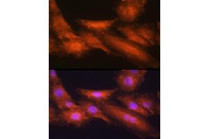 Immunofluorescence analysis of H9C2 cells using [KO Validated] HINT1 Rabbit pAb  at dilution of 1:100 (40x lens). (HINT1 抗体  (AA 1-126))