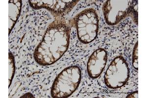 Immunoperoxidase of monoclonal antibody to ACOT7 on formalin-fixed paraffin-embedded human colon. (ACOT7 抗体  (AA 1-338))