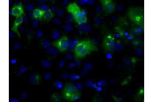 Anti-LIPG mouse monoclonal antibody (ABIN2453248) immunofluorescent staining of COS7 cells transiently transfected by pCMV6-ENTRY LIPG (RC209248). (LIPG 抗体)