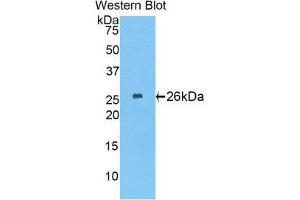 Western Blotting (WB) image for anti-Laminin, beta 2 (Laminin S) (LAMB2) (AA 1498-1716) antibody (ABIN1859603) (LAMB2 抗体  (AA 1498-1716))