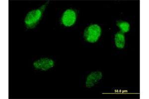 Immunofluorescence of purified MaxPab antibody to RAD51L3 on HeLa cell. (RAD51D 抗体  (AA 1-216))