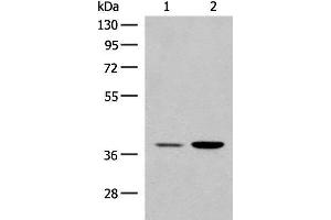 Western blot analysis of HEPG2 and K562 cell lysates using MRM1 Polyclonal Antibody at dilution of 1:400 (MRM1 抗体)