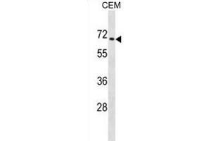 ZNF93 Antibody (N-term) (ABIN1882040 and ABIN2838921) western blot analysis in CEM cell line lysates (35 μg/lane). (ZNF93 抗体  (N-Term))