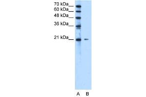 WB Suggested Anti-C20orf24 Antibody Titration:  2. (C20ORF24 抗体  (N-Term))